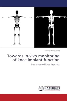 Paperback Towards in-vivo monitoring of knee implant function Book