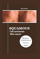 SQUAMOUS CELL CARCINOMA SKIN CANCER: The Illustrated Guide: Types, Diagnosis, Treatment, Prevention, Resources, Management And Question to ask your doctor B0CRRVGMR2 Book Cover