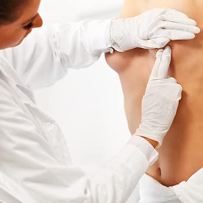 Lifting des seins (cure de ptose mammaire) &agrave; Paris 16&egrave;me