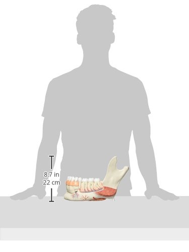 Amazon.co.jp: 下顎，3倍大・19分解モデル（蝕歯付） - 3B Scientific