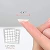 AUSLKA-160-PatchBlemish-Pimple-Patches-Zit-Stickers-Blemish-Spot-Patch-Hydrocolloid-Blemish-Dots-for-Face AUSLKA (160 Patch) Acne Pimple Patches, Zit Stickers, Blemish Spot Patch, Hydrocolloid Acne Pimple Patch for Face Zit…