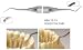 Osung Hoe Scaler, Dental Anterior Hoe Scaler, Standard Dental Periodontal Hoe Scaler Instrument, Dental Hoe Scaler - HSA12-13