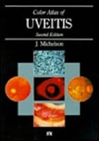 Color Atlas of Uveitis 0815158998 Book Cover