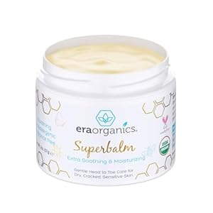 Era Organics Healing Ointment for Babies – USDA Certified Organic Natural Gentle Moisturizer for Sensitive Skin Prone To Baby Eczema, Cradle Cap (Infant Seborrheic Dermatitis), Rashes, Hives & More