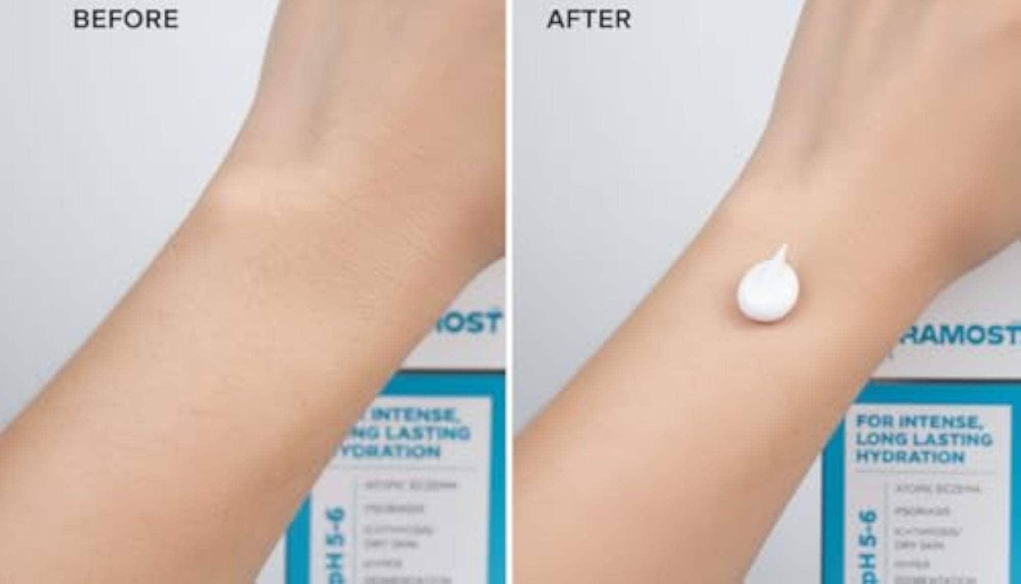 Intensive Moisturiser Lotion 200ml for Dry Skin