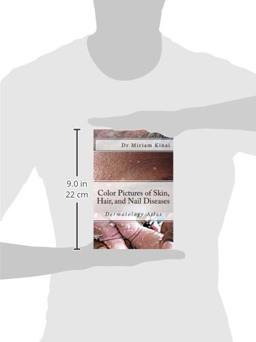 Color Pictures of Skin, Hair and Nail Diseases: Dermatology Atlas