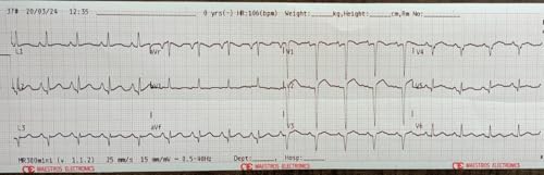 Image of Maestros MR 300 mini Three Channel ECG Machine (Made in India)