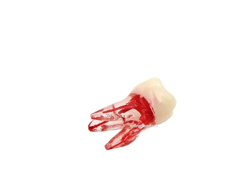 Ningfan M8008-36# Dental Endodontic Root Canal Teeth Modle thumb #3
