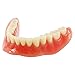 Dental Teaching Model Overdenture Inferior with 2 Implants Demo #6002