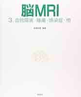 脳MRI 3.血管障害・腫瘍・感染症・他 | 高橋昭喜, 高橋昭喜 |本