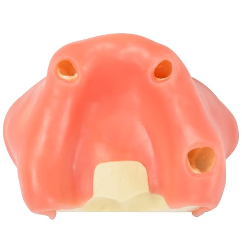 Ultrassist Dental Sinus Lifting & Implant Placement Practice Mode A, Basic Implant Training Model with Practice Soft Gums, Great Dental Training Tooth for Dental Implant Practice