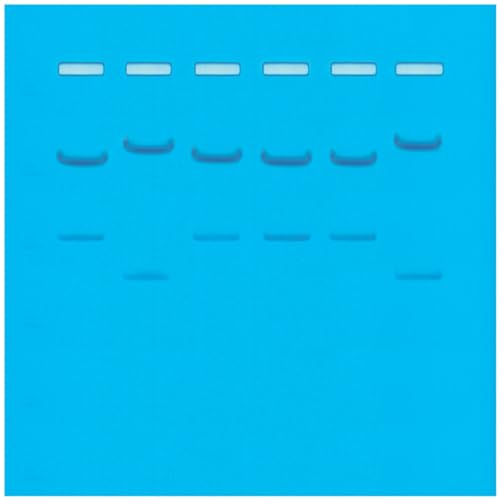 DNA Fingerprinting by Restriction Enzyme Patterns,Group Size for 8 Gels