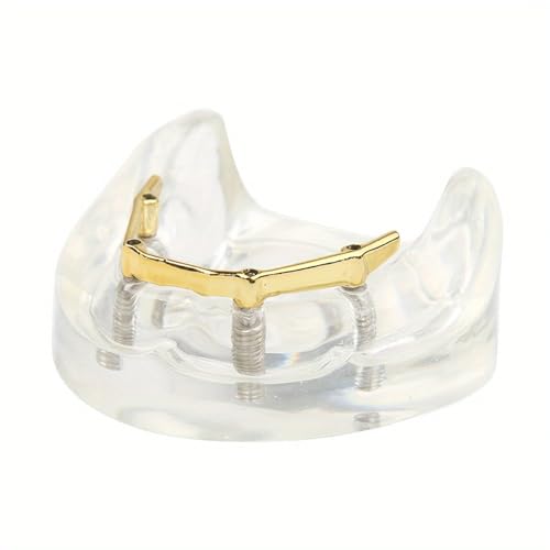 Transparent Dental Lower Jaw Implant Model Dental Demonstration Model for Education and Study Model Tool, Golden