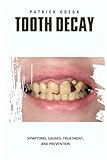 odigeo barcelona  TOOTH DECAY: Symptoms, Causes, Treatment, and Prevention