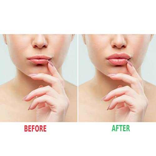 Kiss Beauty Lip Maximizer: Hyaluronic Acid Plumping Gloss For Fuller, Moisturized Lips - Natural Volumizing Serum, Collagen Booster, Non-sticky Formula - Image 4