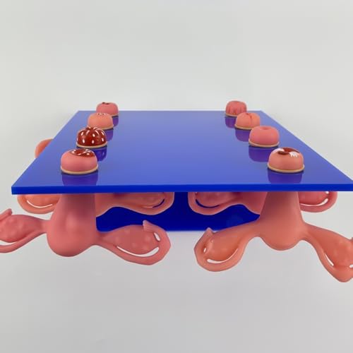 Modelo de útero patológico ideal para simulaciones médicas y consultas ginecológicas