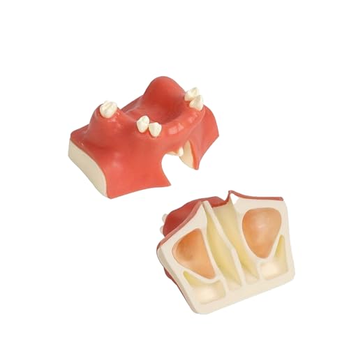 Dental Maxillary Sinus Model, Maxillary Sinus Lift Practice Model with Soft Gums for Training Teaching Demo