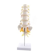 Algopix Similar Product 9 - Lumbar Vertebrae Vertebral Nerve Model