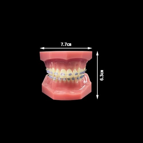 Orthodontisches Zahnmodell mit Halterungen, YOUYA DENTAL Demonstration Orthodontisches Modell für Bildung, Zähne Demonstration Typodonte Anatomisches Lehrwerkzeug mit Metall und Keramischer Halterung