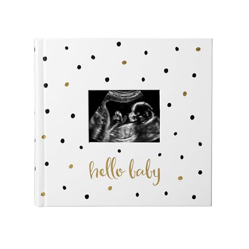 Image of Pearhead Hello Baby Photo Album, Keepsake Book for New and Expecting Parents, Gender-Neutral Baby Accessory, Ideal Gift for Baby Shower, Holds 200 Pictures, Black and Gold Polka Dot