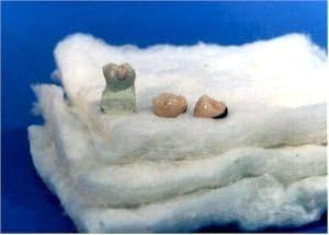 MDL Dental Ceramic Firing Pillows - 4pk 4x4 Squares