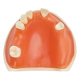 Ultrassist Maxillary Dental Implant Model, Basic Implant Training Model with Practice Soft Gums, Great Dental Training Tooth for Dental Implant Practice