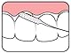 TePe Bridge und Implant Floss, 1er Pack (1 x 30 Stück)