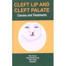 Buy CLEFT LIP AND CLEFT PALATE : CAUSES & TREATMENT Book Online at Low ...