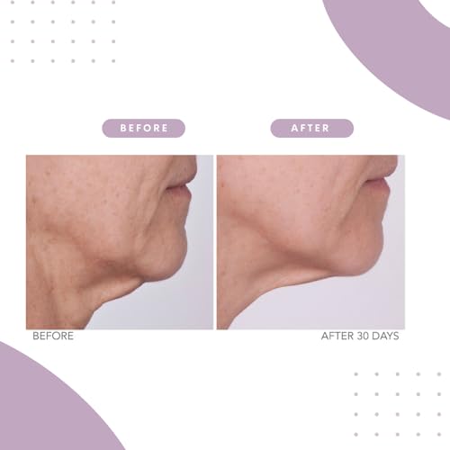 Serious Skincare Reverse Lift CORREC-CHIN - Firming Cream with Collagen - Contours & Sculpts Double Chin & Jawline - Visibly Tighten Sagging Skin - Anti-Aging Moisturizer with Glaucine - 2 Oz.