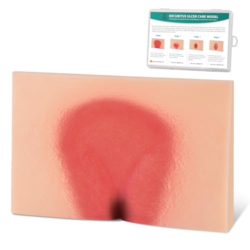 Image of Decubitus Ulcer Wound Care Model, Bedsores Model