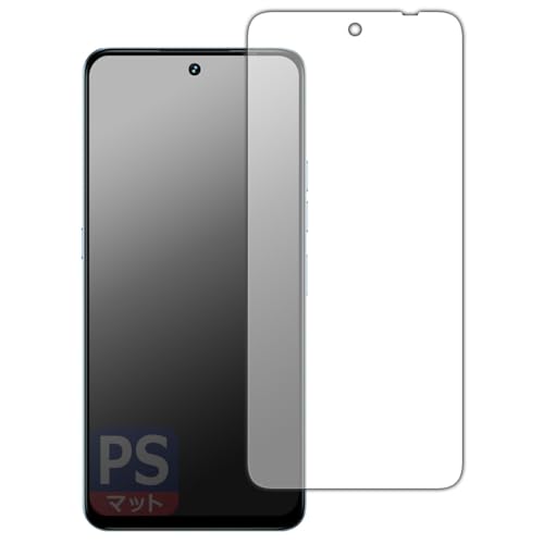 PDAH[ UMIDIGI Note 100 5G Ή PerfectShield ی tB [ʗp] ˒ጸ hw {
