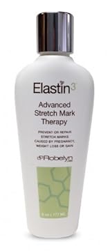 stretch mark laser therapy