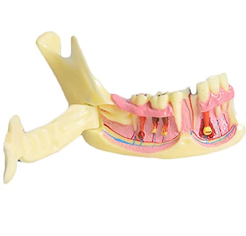 Modelo de mandíbula inferior dental para el estudio anatómico del tejido óseo