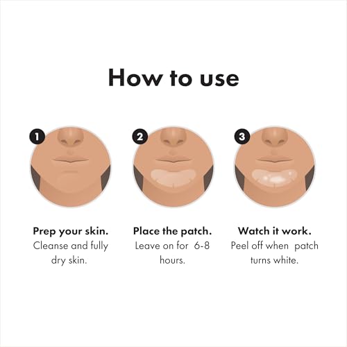 Patchs menton hydrocolloïdes Mighty Patch pour stopper les boutons rebelles sans irriter la peau