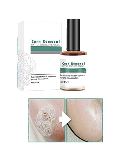 KBLLNPBP Corn Callus Remover Liquid for Feet Extra Strength, Corn Removal Extra Strengthen Gel, Corn Remover Liquid, Corn Callus Remover for Feet, Remove Calluses from Feet for All Skin Types, 1pcs