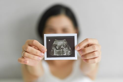 Sony Paper UPP-110HD High Density Printing Paper - Box of 10 Rolls