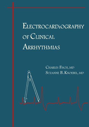 Electrocardiography of Clinical Arrhythmias