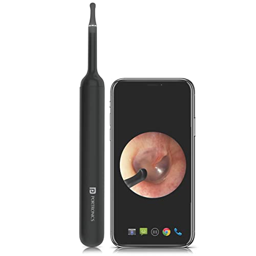 Portronics Xlife Smart Wireless Ear Otoscope Cleaner with 6 LED Lights, FHD 1080 Camera, 3 Mega pixels Endoscope, Control V…