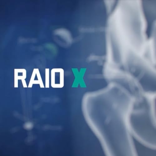『Raio X』のカバーアート
