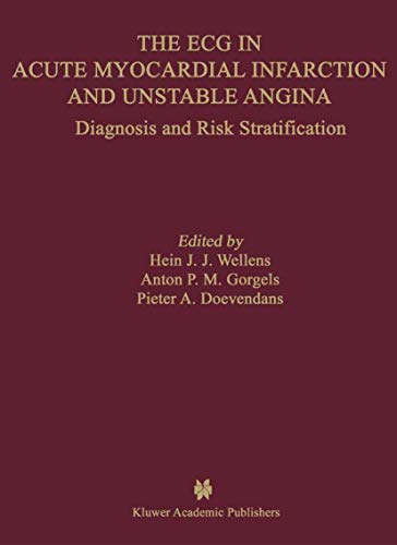 The ECG in Acute Myocardial Infarction and Unstable Angina: Diagnosis and Risk Stratification (Developments in Cardiovascular Medicine Book 245) (English Edition)