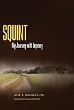 Squint: My Journey with Leprosy (Willie Morris Books in Memoir and Biography)