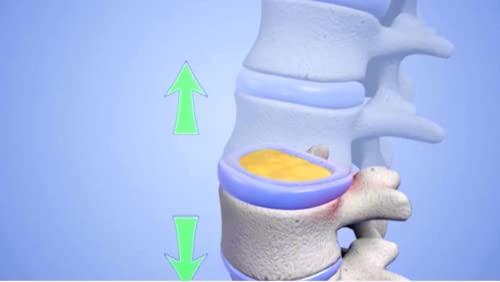 Neck-Ease-Cervical-Traction-Device-Foot-Powered-Safe-Effective-Neck-Pain-Therapy-at-Home