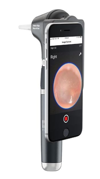 Image of Welch Allyn 3.5V LED Macroview Plus Otoscope With Lithium Ion Plus USB Handle and Iexaminer Smart Bracket
