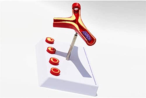 Anatomie Model, Educatief Model Anatomie Atherosclerose Model Trombus Trombose Vasculair Model Arterieel Bloedvat… - Image 3
