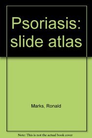 Psoriasis: slide atlas