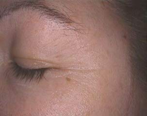 ETÈRNA - Siero occhi ad azione immediata - Acido