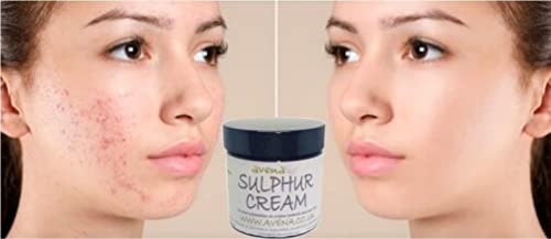Wellmadefairtrade Herbalshire Sulphur Cream Natural Sulphur Ointment Cream Sulphur Acne Sulphur Body Cream 35g - Image 3