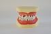 S&D Dental Teaching Demonstration Model Gingival Diseases Model Peridontal Disease Model Implant Practice Jaw Model Peridontal Disease Model