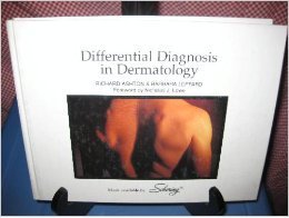 Differential Diagnosis in Dermatology, Second Edition
