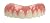2 Pack - Instant Smile Natural Shade Comfort Fit Flex Veneers - Fix your smile from the comfort of your own home in just minutes! Hand Crafted
